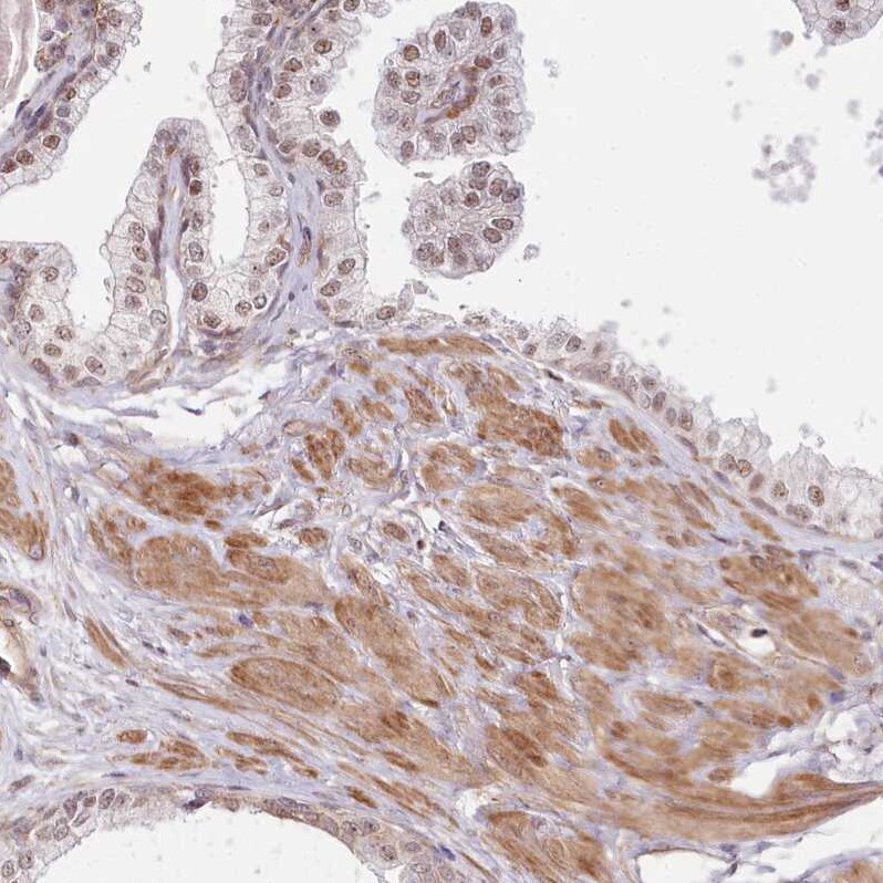 TUBGCP2 Antibody - BSA Free Immunohistochemistry-Paraffin: TUBGCP2 Antibody [NBP1-81841]