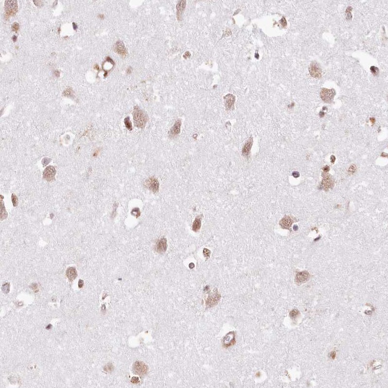 TUBGCP2 Antibody - BSA Free Immunohistochemistry-Paraffin: TUBGCP2 Antibody [NBP1-81841]