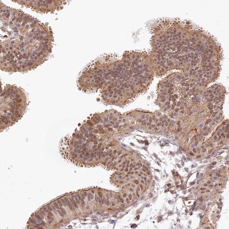 TUBGCP2 Antibody - BSA Free Immunohistochemistry-Paraffin: TUBGCP2 Antibody [NBP1-81841]
