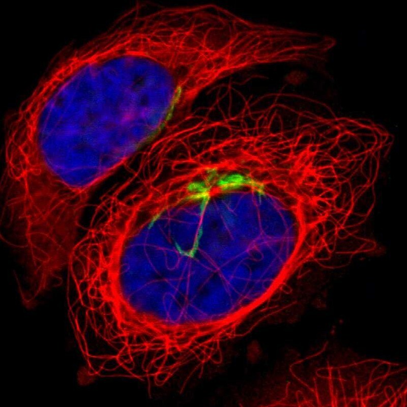 Polypeptide GalNac Transferase 3/GALNT3 Antibody - BSA Free Immunocytochemistry/ Immunofluorescence: Polypeptide GalNac Transferase 3/GALNT3 Antibody [NBP1-81849]