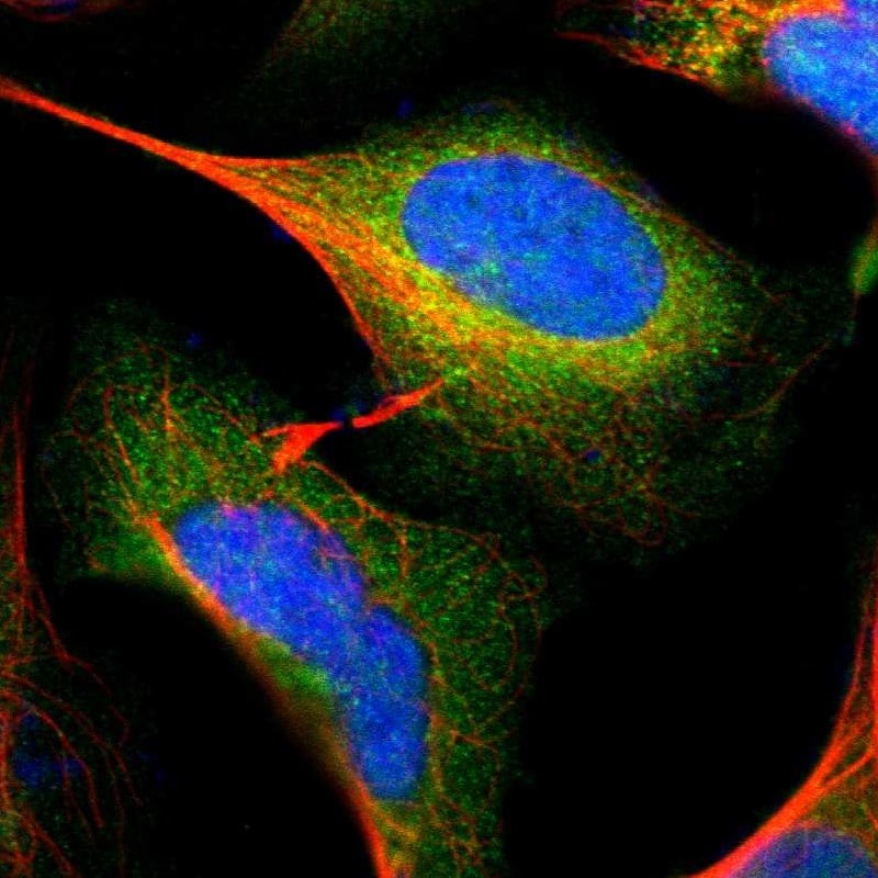 GALK1 Antibody - BSA Free Immunocytochemistry/ Immunofluorescence: GALK1 Antibody [NBP1-81853]