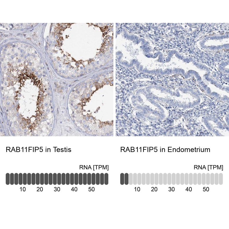 RAB11FIP5 Antibody - BSA Free Immunohistochemistry-Paraffin: RAB11FIP5 Antibody [NBP1-81855]