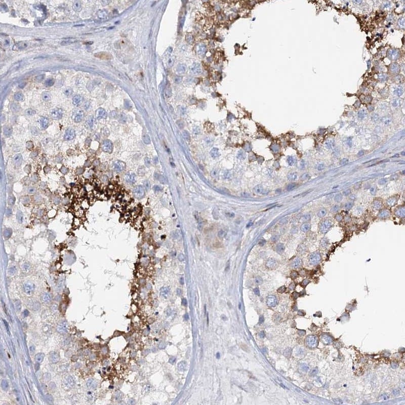 RAB11FIP5 Antibody - BSA Free Immunohistochemistry-Paraffin: RAB11FIP5 Antibody [NBP1-81855]
