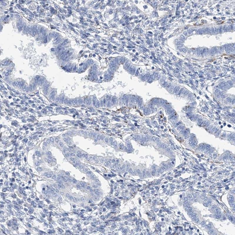 RAB11FIP5 Antibody - BSA Free Immunohistochemistry-Paraffin: RAB11FIP5 Antibody [NBP1-81855]