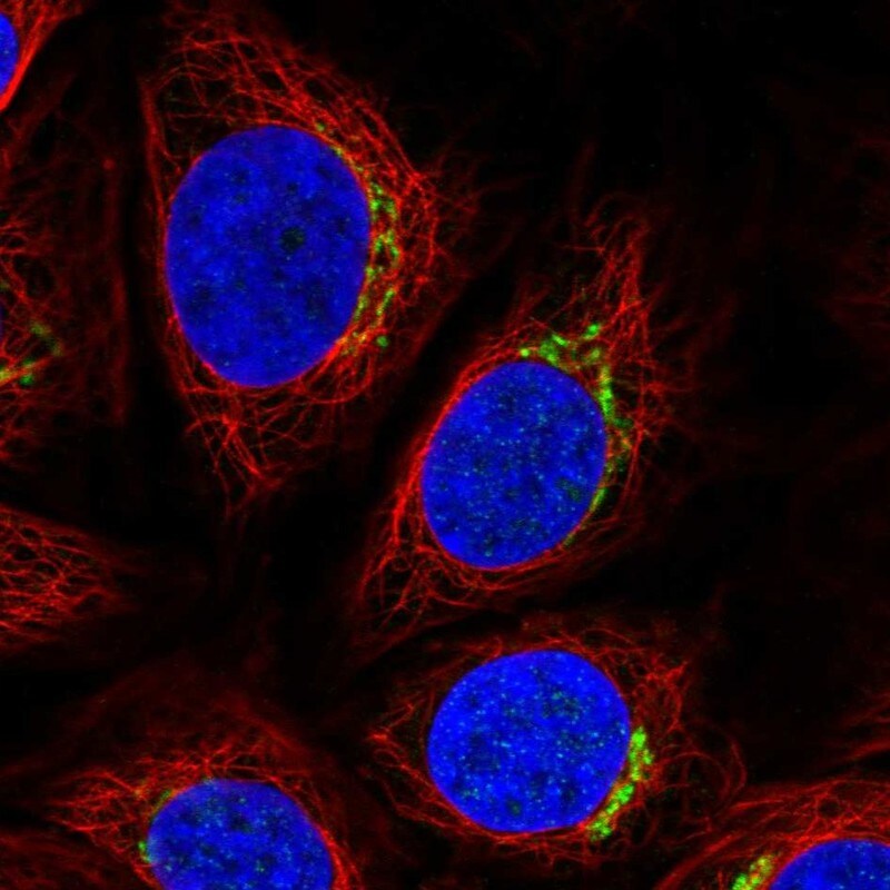 RNF24 Antibody - BSA Free Immunocytochemistry/ Immunofluorescence: RNF24 Antibody [NBP1-81859]