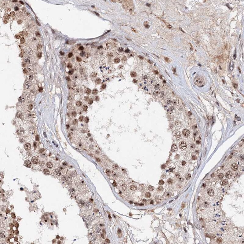 BUD13 Antibody - BSA Free Immunohistochemistry-Paraffin: BUD13 Antibody [NBP1-81863]