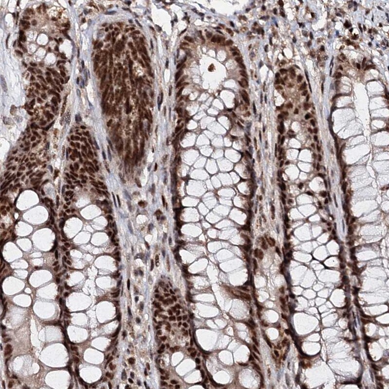BUD13 Antibody - BSA Free Immunohistochemistry-Paraffin: BUD13 Antibody [NBP1-81863]