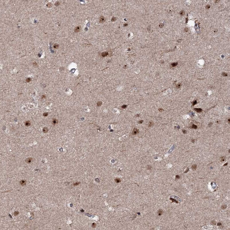 BUD13 Antibody - BSA Free Immunohistochemistry-Paraffin: BUD13 Antibody [NBP1-81863]