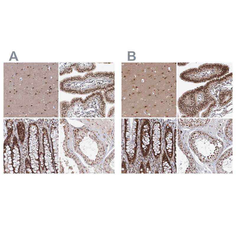BUD13 Antibody - BSA Free Immunohistochemistry-Paraffin: BUD13 Antibody [NBP1-81863]