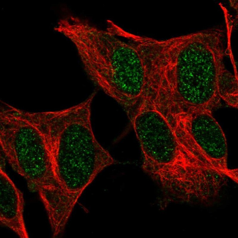 FOXR2 Antibody - BSA Free Immunocytochemistry/ Immunofluorescence: FOXR2 Antibody [NBP1-81870]
