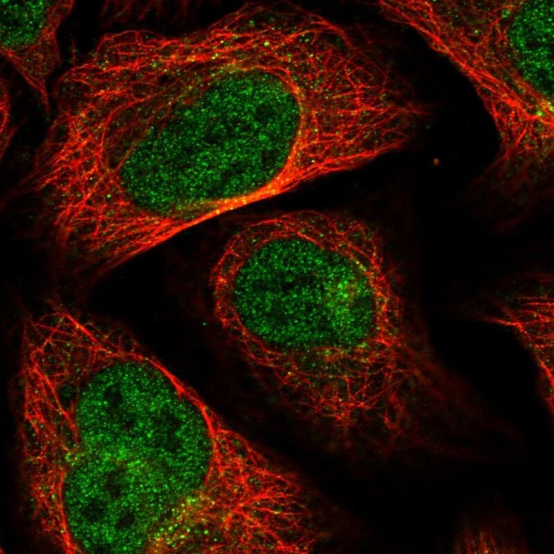 MTFMT Antibody - BSA Free Immunocytochemistry/ Immunofluorescence: MTFMT Antibody [NBP1-81871]