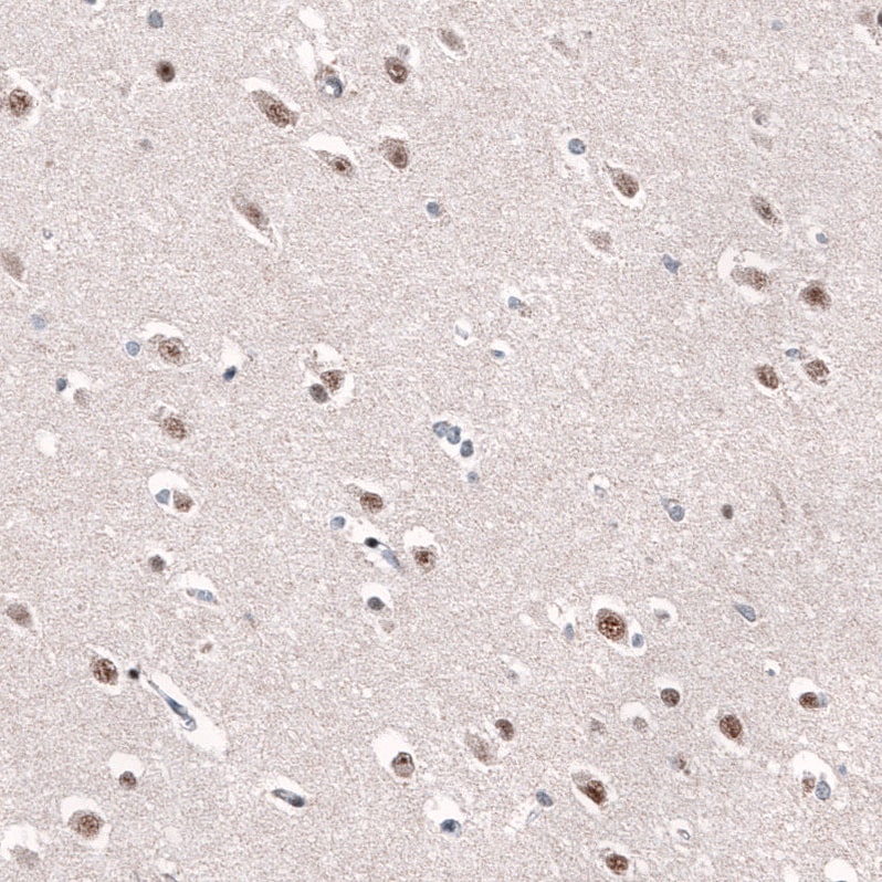 AFF2 Antibody - BSA Free Immunohistochemistry: AFF2 Antibody - BSA Free [NBP1-81872]