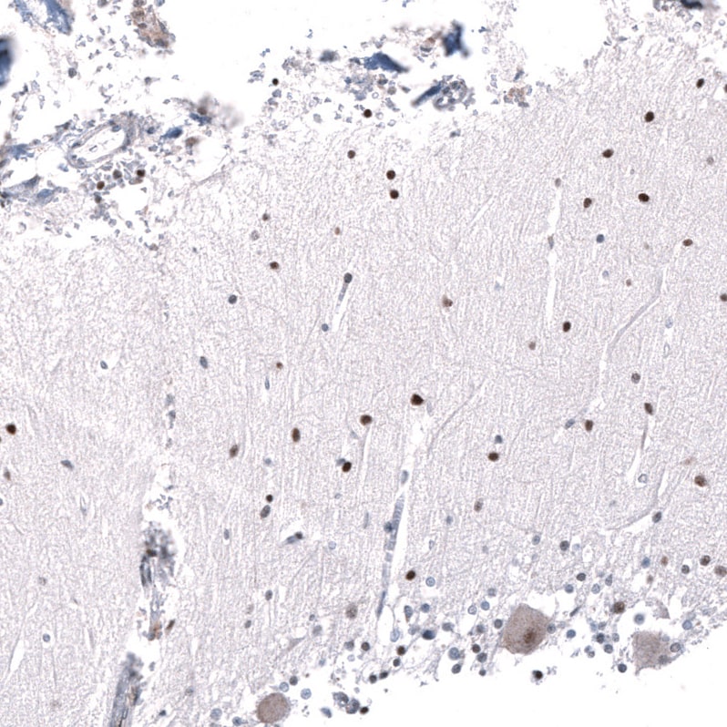 AFF2 Antibody - BSA Free Immunohistochemistry: AFF2 Antibody - BSA Free [NBP1-81872]