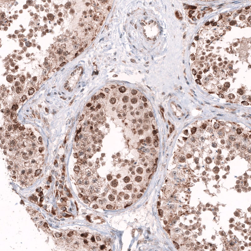 AFF2 Antibody - BSA Free Immunohistochemistry: AFF2 Antibody - BSA Free [NBP1-81872]