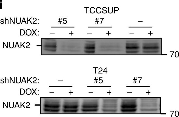 NUAK2 Antibody