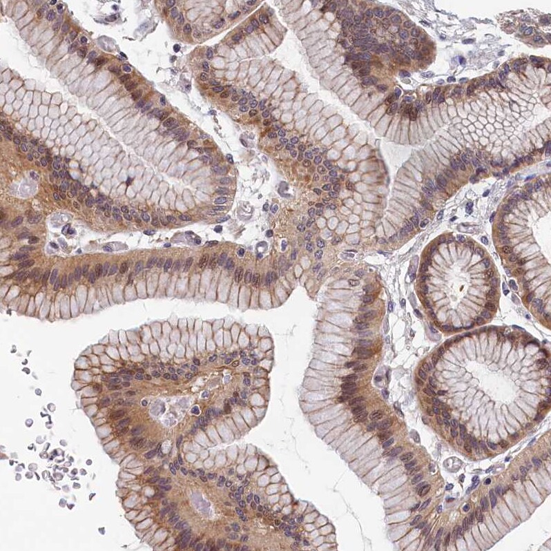 TMEM116 Antibody - BSA Free Immunohistochemistry-Paraffin: TMEM116 Antibody [NBP1-81881]