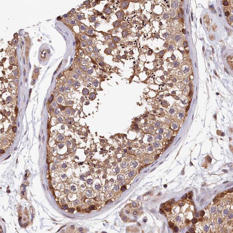 TMEM116 Antibody - BSA Free Immunohistochemistry-Paraffin: TMEM116 Antibody [NBP1-81881]
