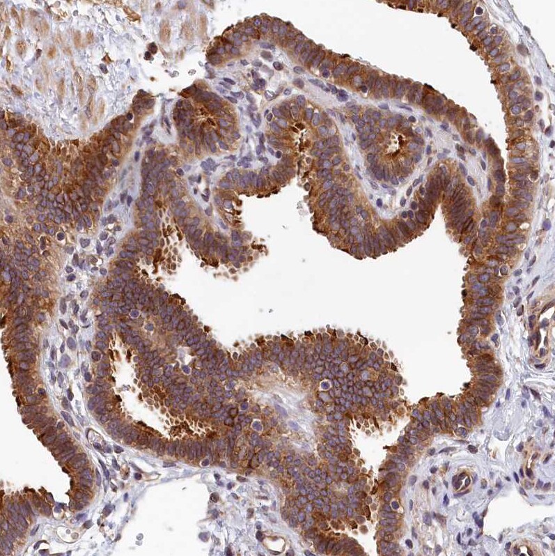 TMEM116 Antibody - BSA Free Immunohistochemistry-Paraffin: TMEM116 Antibody [NBP1-81881]