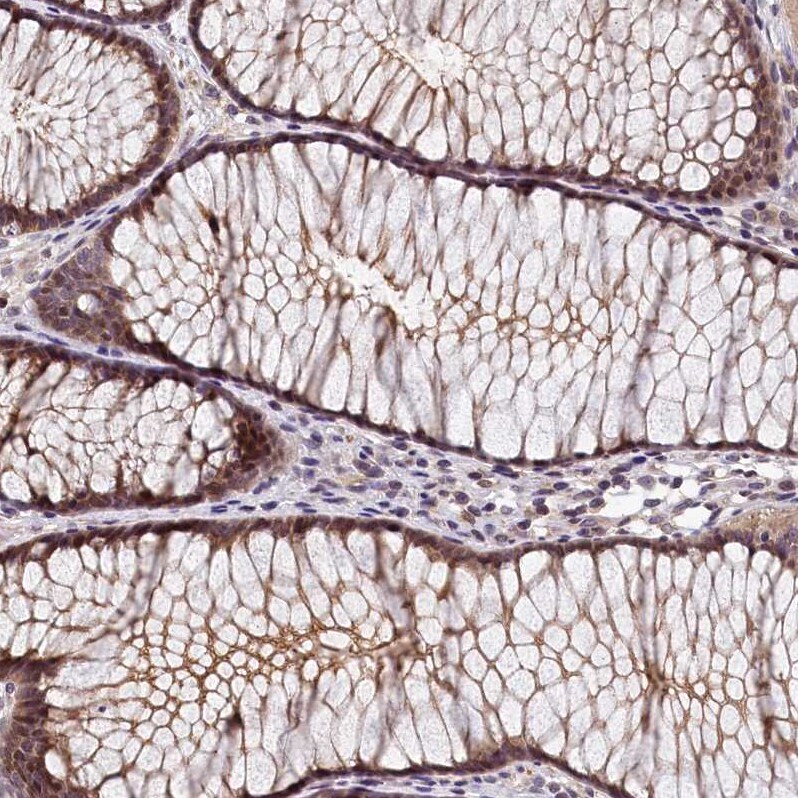 TMEM116 Antibody - BSA Free Immunohistochemistry-Paraffin: TMEM116 Antibody [NBP1-81881]