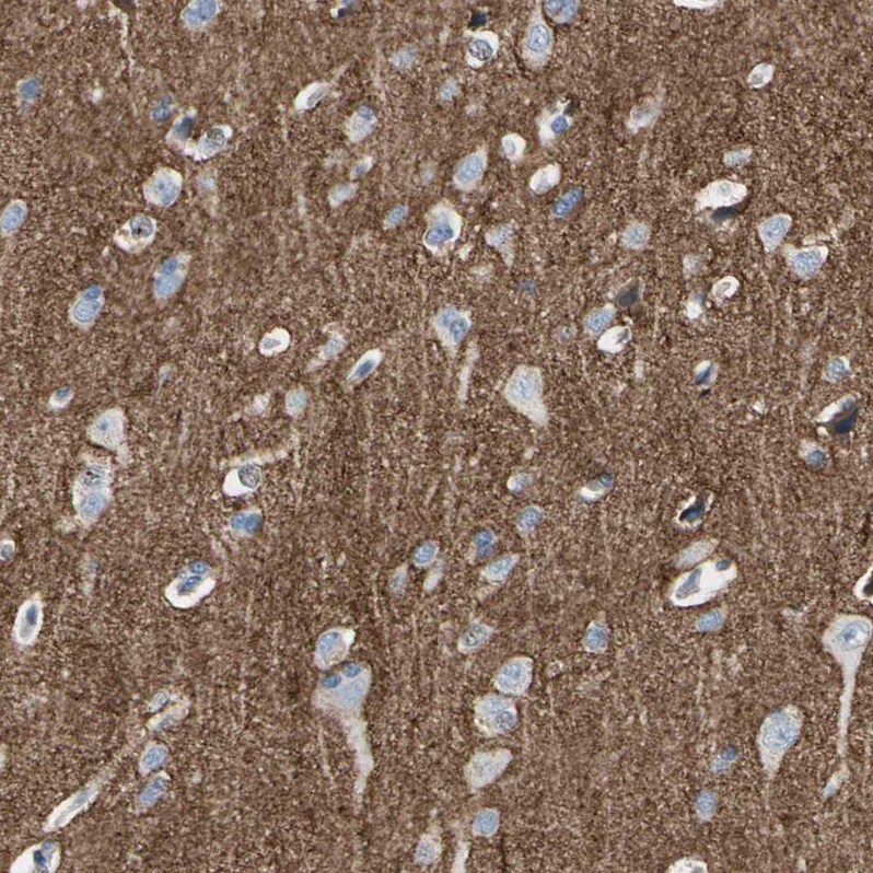 Neurofascin Antibody - BSA Free Immunohistochemistry-Paraffin: Neurofascin Antibody [NBP1-81886]
