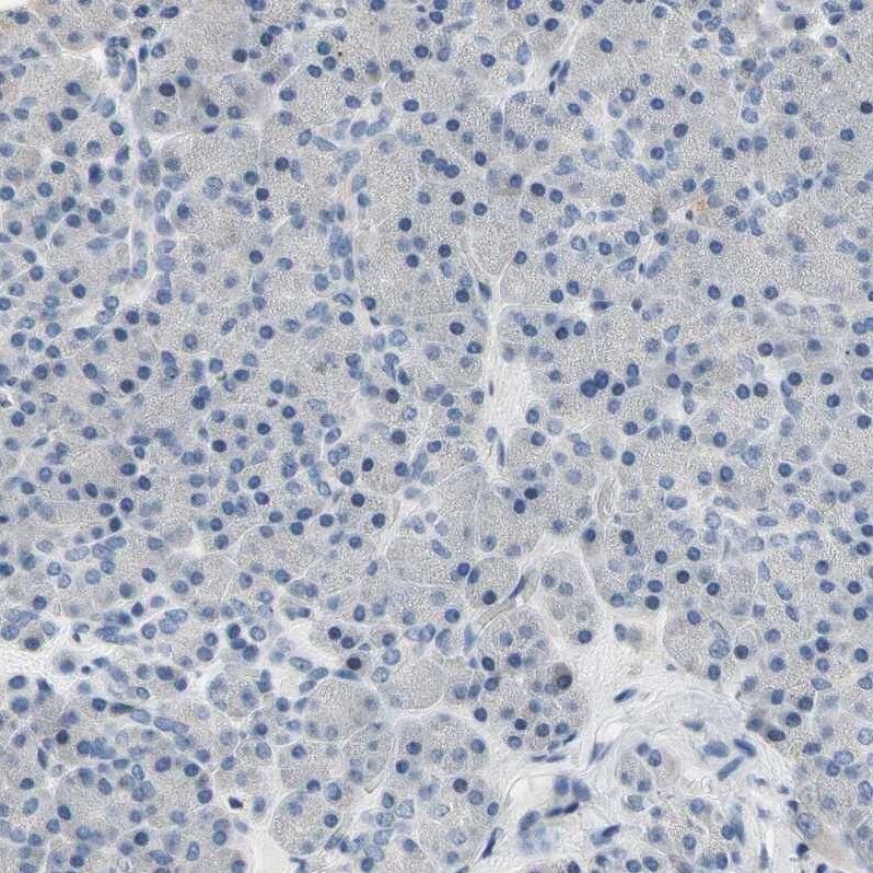 Neurofascin Antibody - BSA Free Immunohistochemistry-Paraffin: Neurofascin Antibody [NBP1-81886]