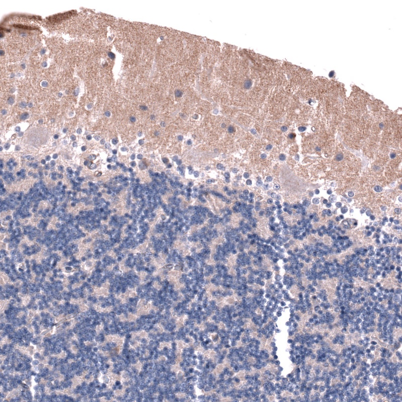 LRRC55 Antibody - BSA Free Immunohistochemistry: LRRC55 Antibody - BSA Free [NBP1-81890]