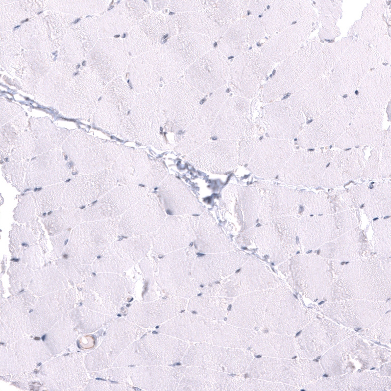 LRRC55 Antibody - BSA Free Immunohistochemistry: LRRC55 Antibody - BSA Free [NBP1-81890]