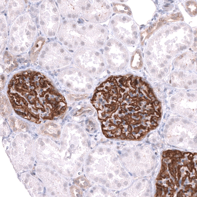 LRRC55 Antibody - BSA Free Immunohistochemistry: LRRC55 Antibody - BSA Free [NBP1-81890]