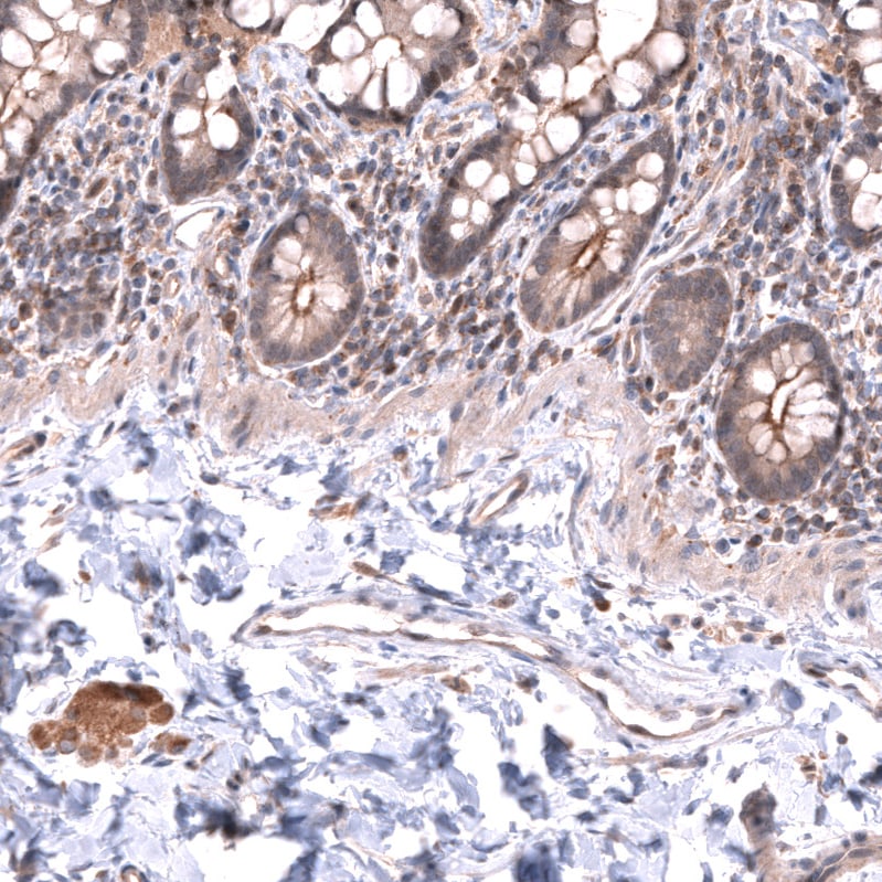 LRRC55 Antibody - BSA Free Immunohistochemistry: LRRC55 Antibody - BSA Free [NBP1-81890]