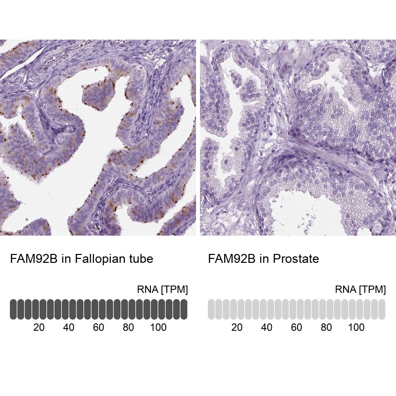 FAM92B Antibody - BSA Free Immunohistochemistry-Paraffin: FAM92B Antibody [NBP1-81895]