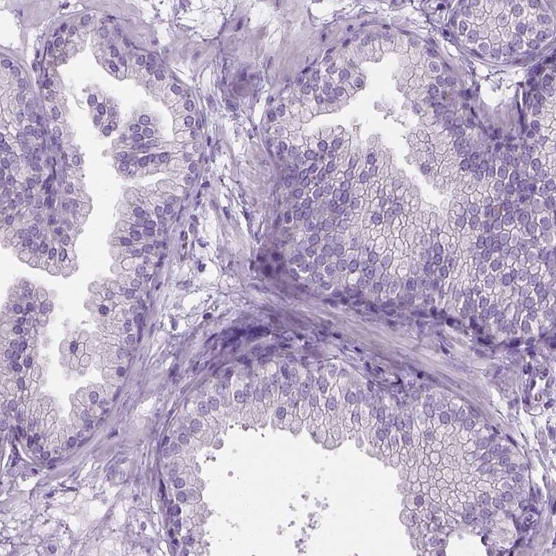 FAM92B Antibody - BSA Free Immunohistochemistry-Paraffin: FAM92B Antibody [NBP1-81895]