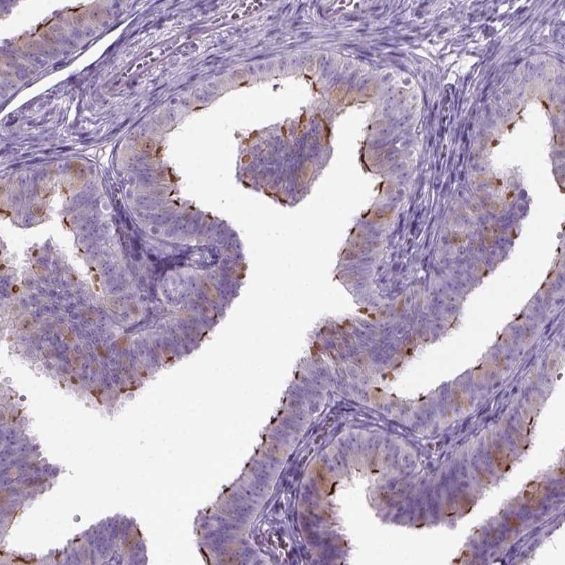 FAM92B Antibody - BSA Free Immunohistochemistry-Paraffin: FAM92B Antibody [NBP1-81895]