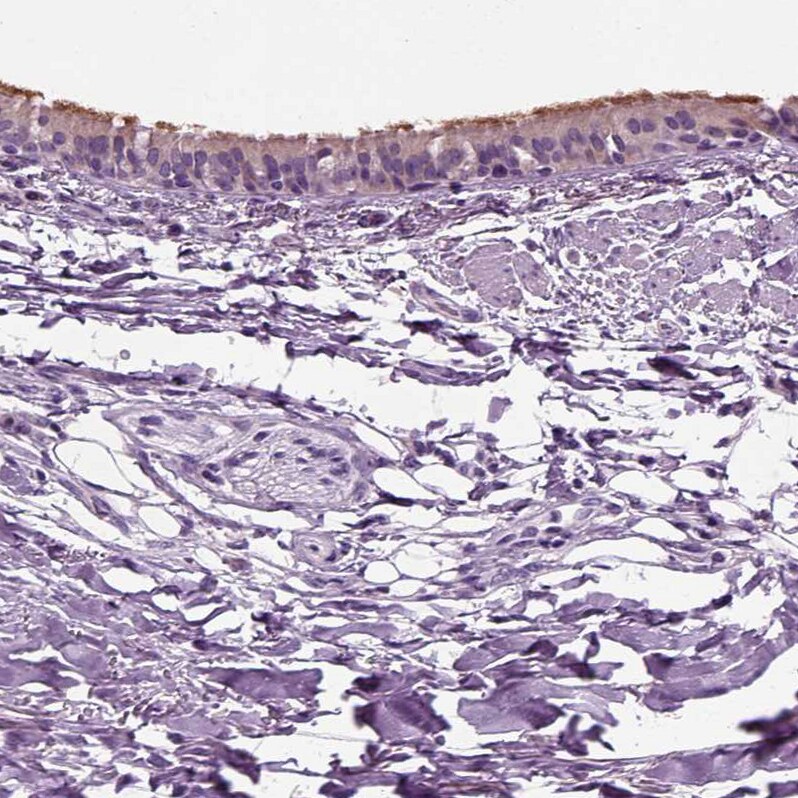 DNAH10 Antibody - BSA Free Immunohistochemistry: DNAH10 Antibody [NBP1-81898]