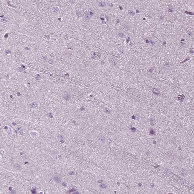 DNAH10 Antibody - BSA Free Immunohistochemistry: DNAH10 Antibody [NBP1-81898]