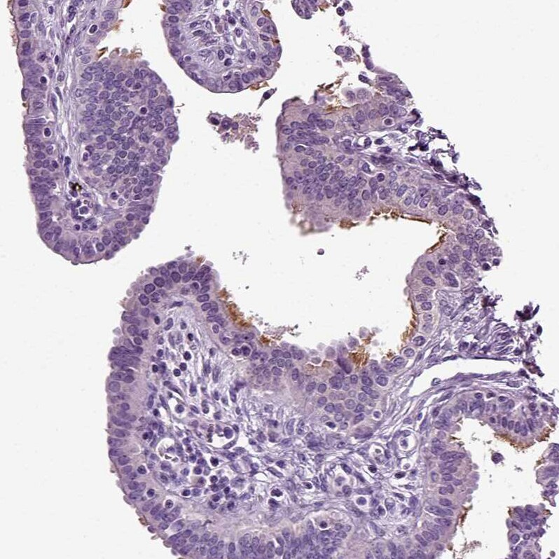 DNAH10 Antibody - BSA Free Immunohistochemistry: DNAH10 Antibody [NBP1-81898]