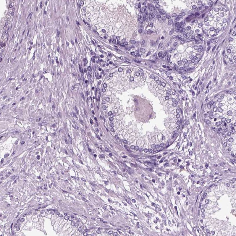 DNAH10 Antibody - BSA Free Immunohistochemistry: DNAH10 Antibody [NBP1-81898]