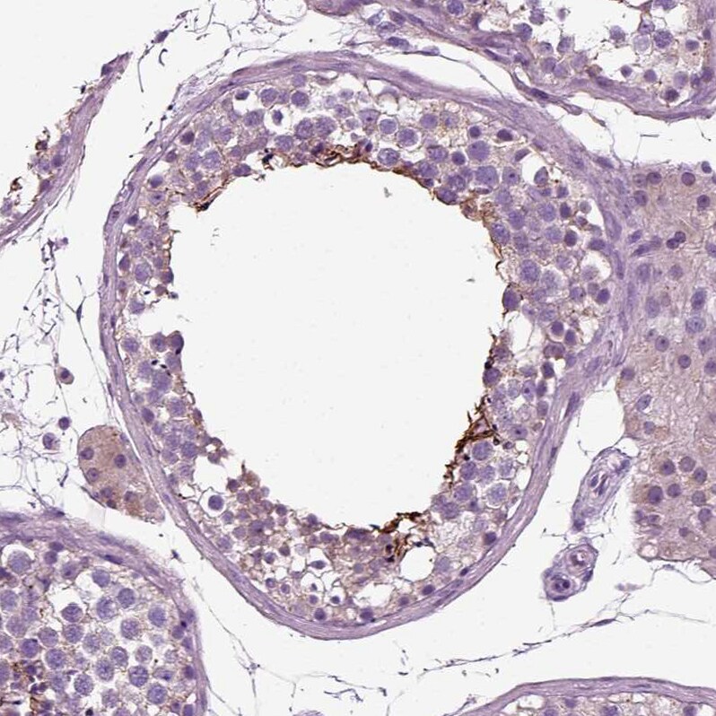 DNAH10 Antibody - BSA Free Immunohistochemistry: DNAH10 Antibody [NBP1-81898]