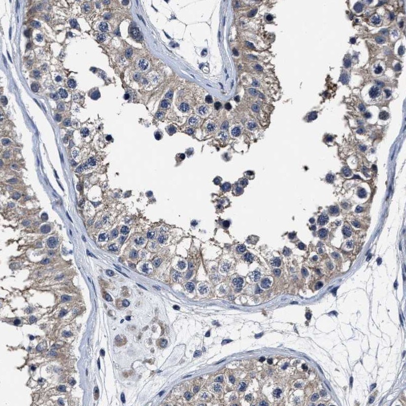 RSBN1L Antibody - BSA Free Immunohistochemistry-Paraffin: RSBN1L Antibody [NBP1-81903]