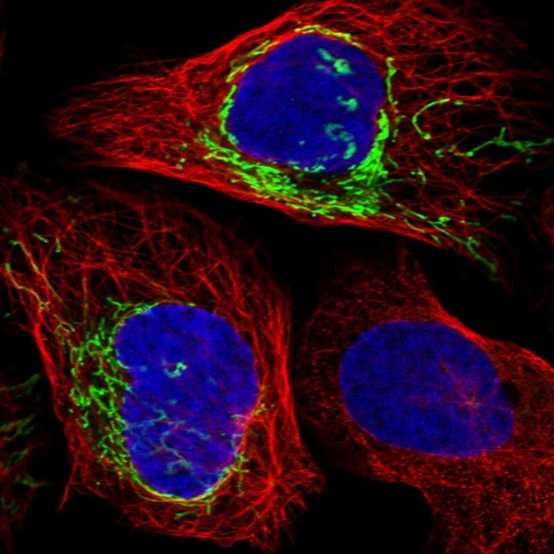 PLD5 Antibody - BSA Free Immunocytochemistry/ Immunofluorescence: PLD5 Antibody [NBP1-81911]