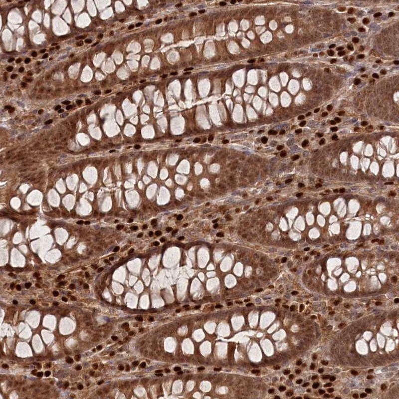 BORCS7 Antibody - BSA Free Immunohistochemistry-Paraffin: BORCS7 Antibody [NBP1-81912]