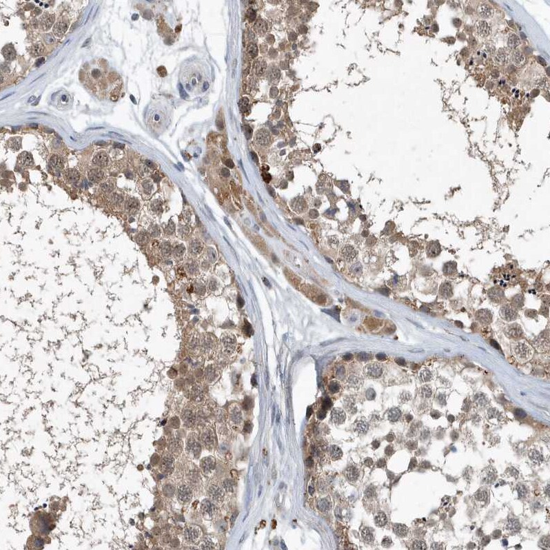 SCFD2 Antibody - BSA Free Immunohistochemistry-Paraffin: SCFD2 Antibody [NBP1-81925]