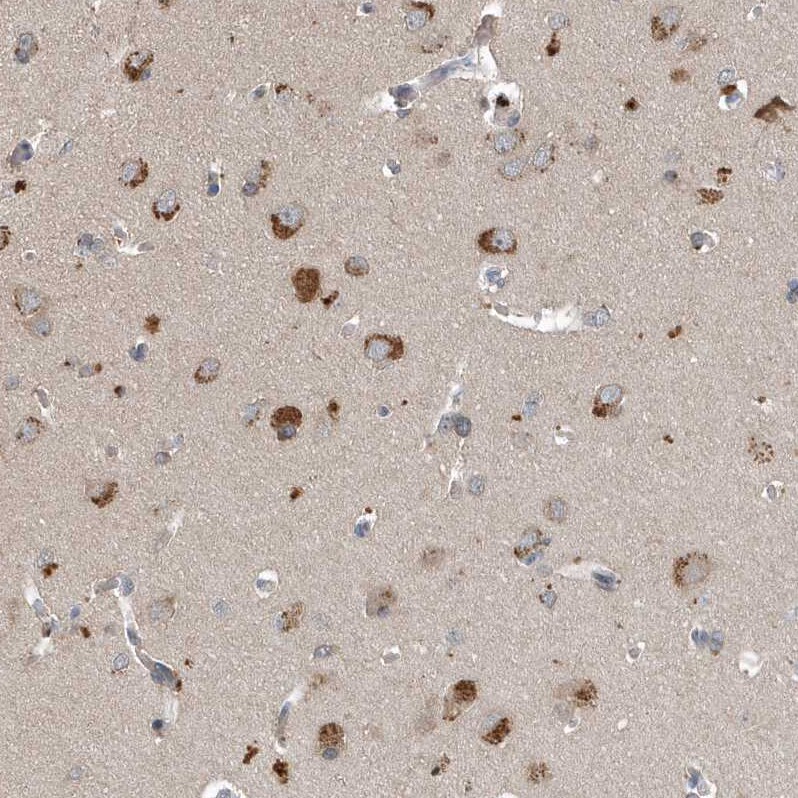 SCFD2 Antibody - BSA Free Immunohistochemistry-Paraffin: SCFD2 Antibody [NBP1-81925]