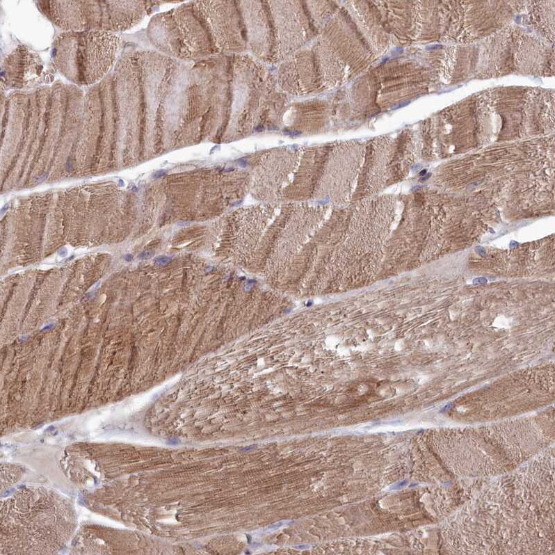 RILPL1 Antibody - BSA Free Immunohistochemistry-Paraffin: RILPL1 Antibody [NBP1-81928]