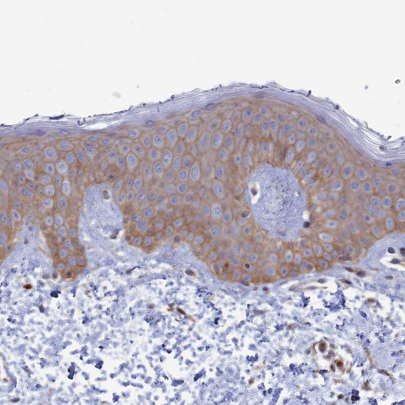RILPL1 Antibody - BSA Free Immunohistochemistry-Paraffin: RILPL1 Antibody [NBP1-81928]