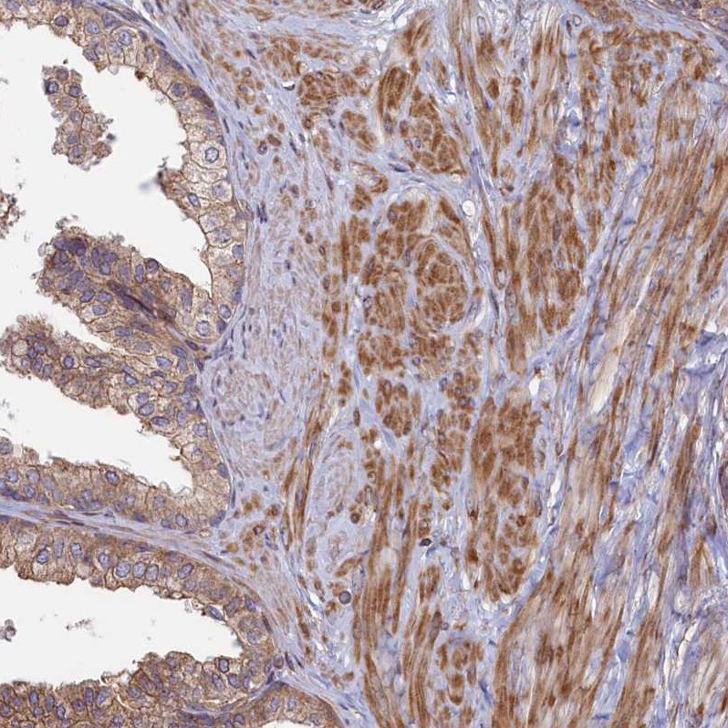 RILPL1 Antibody - BSA Free Immunohistochemistry-Paraffin: RILPL1 Antibody [NBP1-81928]
