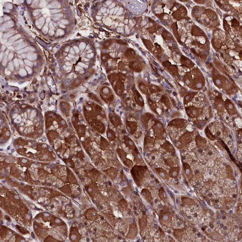 MEX3C Antibody - BSA Free Immunohistochemistry-Paraffin: MEX3C Antibody [NBP1-81932]