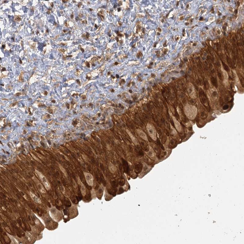 ZNF549 Antibody - BSA Free Immunohistochemistry-Paraffin: ZNF549 Antibody [NBP1-81970]