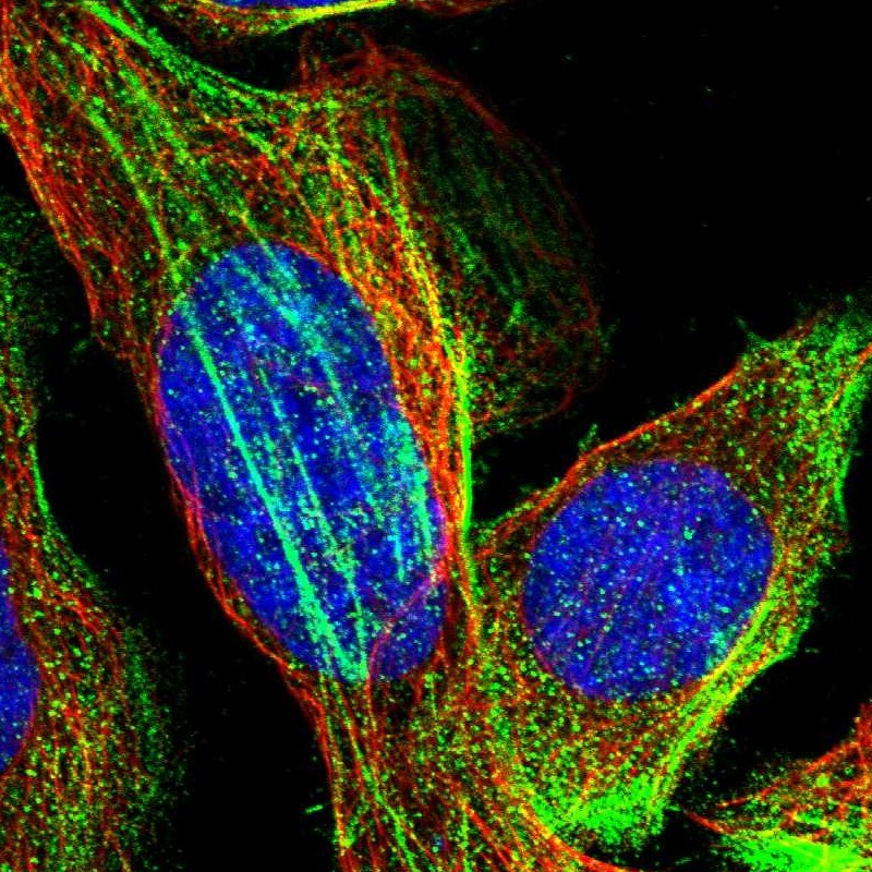 TMEM17 Antibody - BSA Free Immunocytochemistry/ Immunofluorescence: TMEM17 Antibody [NBP1-81974]