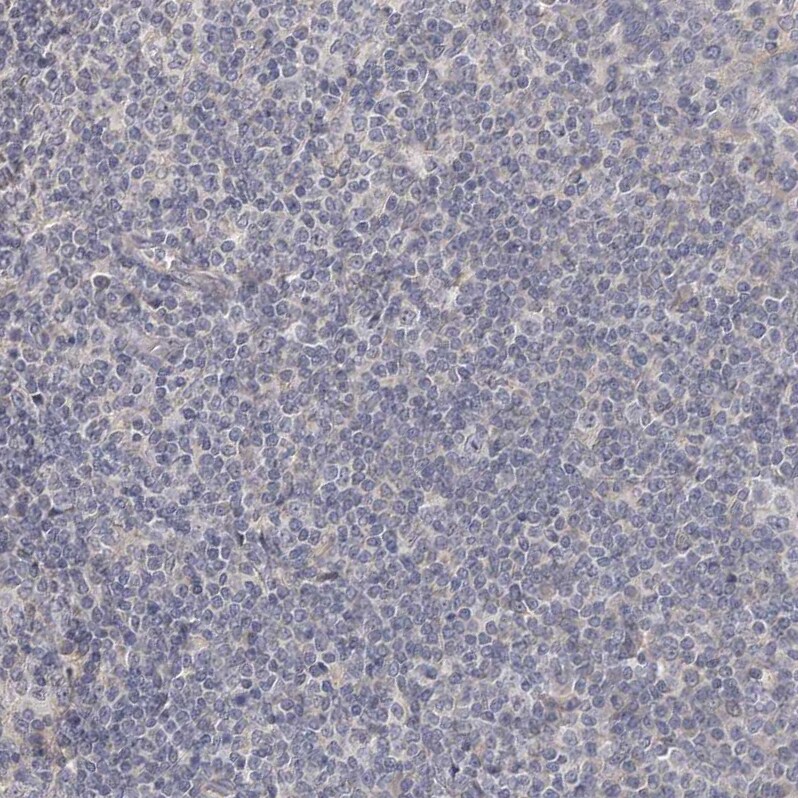 HINT3 Antibody - BSA Free Immunohistochemistry-Paraffin: HINT3 Antibody [NBP1-81981]