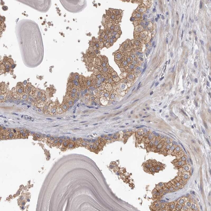 HINT3 Antibody - BSA Free Immunohistochemistry-Paraffin: HINT3 Antibody [NBP1-81981]